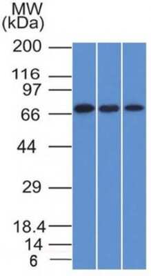 Western Blot: Endoglin/CD105 Antibody (ENG/1326)Azide and BSA Free [NBP2-54518]