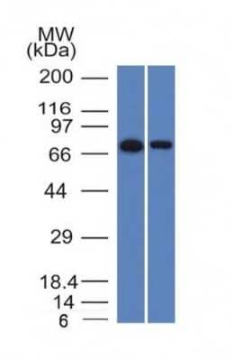 Western Blot: Endoglin/CD105 Antibody (ENG/1327) [NBP2-53334]