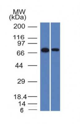 Western Blot: Endoglin/CD105 Antibody (ENG/1327)Azide and BSA Free [NBP2-54517]