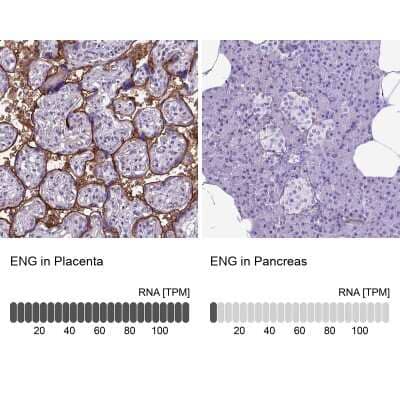 Immunohistochemistry-Paraffin: Endoglin/CD105 Antibody [NBP2-49516]