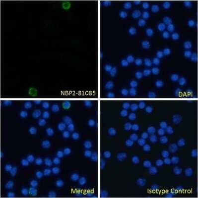 Immunocytochemistry/ Immunofluorescence: Endoglin/CD105 Antibody (MJ7/18) - Chimeric - Azide and BSA Free [NBP2-81085]