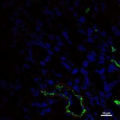 Immunocytochemistry/ Immunofluorescence: Endoglin/CD105 Antibody (MJ7/18) [NB100-77666]