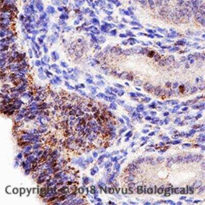 Immunohistochemistry-Paraffin: Endoglin/CD105 Antibody (MJ7/18) [NB100-77666]