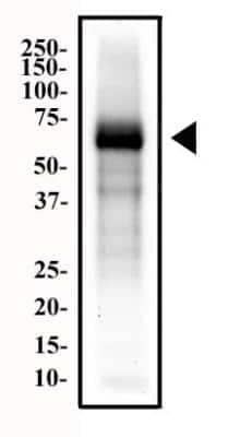 Western Blot: Endoglin/CD105 Antibody (MJ7/18) [NB100-77666]