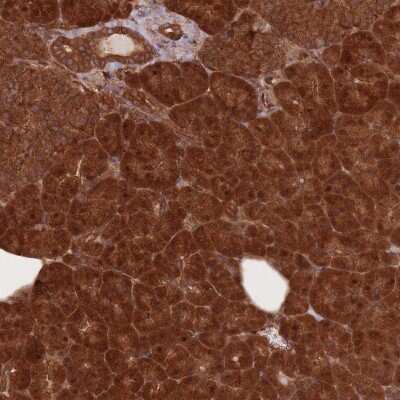 Immunohistochemistry: Endoglycan/PODXL2 Antibody [NBP2-37899]