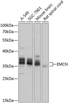 Western Blot: Endomucin/Mucin -14 AntibodyBSA Free [NBP3-03543]