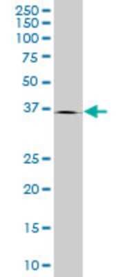 Western Blot: Endophilin A1/SH3GL2 Antibody (2G6) [H00006456-M06]