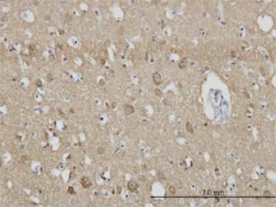 Immunohistochemistry-Paraffin: Endophilin A1/SH3GL2 Antibody (5A6) [H00006456-M01]