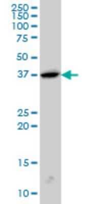 Western Blot: Endophilin A1/SH3GL2 Antibody (5A6) [H00006456-M01]