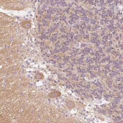 Immunohistochemistry: Endophilin A1/SH3GL2 Antibody [NBP2-38996]