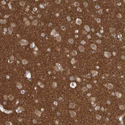 Immunohistochemistry-Paraffin: Endophilin A1/SH3GL2 Antibody [NBP1-85521]
