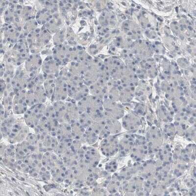 Immunohistochemistry-Paraffin: Endophilin A1/SH3GL2 Antibody [NBP1-85521]