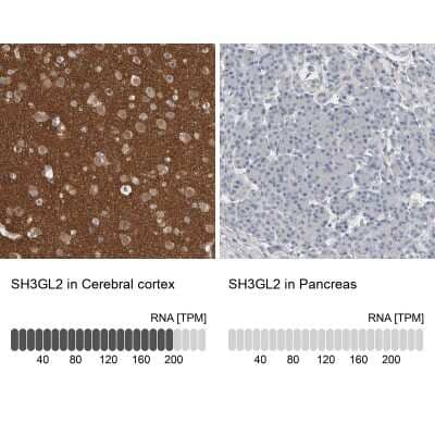 Immunohistochemistry-Paraffin: Endophilin A1/SH3GL2 Antibody [NBP1-85521]