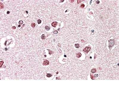 Immunohistochemistry-Paraffin: Endophilin A1/SH3GL2 Antibody [NBP2-26164]