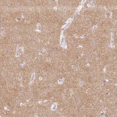Immunohistochemistry-Paraffin: Endophilin A1/SH3GL2 Antibody [NBP2-38996]
