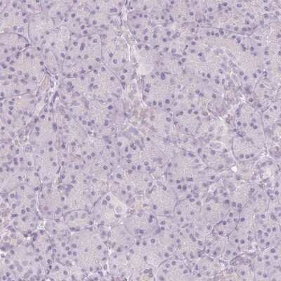 Immunohistochemistry-Paraffin: Endophilin A1/SH3GL2 Antibody [NBP2-38996]