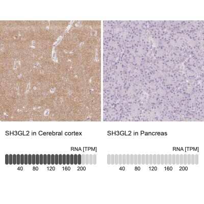 Immunohistochemistry-Paraffin: Endophilin A1/SH3GL2 Antibody [NBP2-38996]