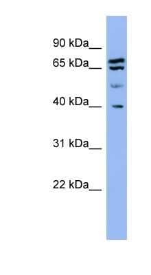 Western Blot: Endophilin A1/SH3GL2 Antibody [NBP1-79629]