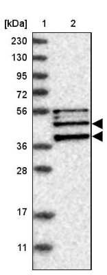 Western Blot: Endophilin A1/SH3GL2 Antibody [NBP1-85521]