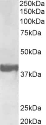 Western Blot: Endophilin A1/SH3GL2 Antibody [NBP2-26164]