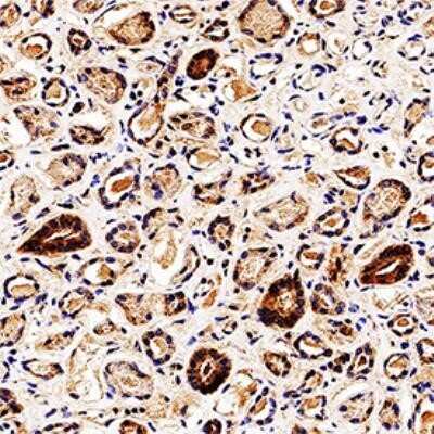 Immunohistochemistry-Paraffin: Endophilin B1/Bif-1 Antibody (30A882.1.1) - Azide Free [NBP2-33258]