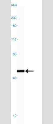 Simple Western: Endophilin B1/Bif-1 Antibody (30A882.1.1)Azide Free [NBP2-33258]