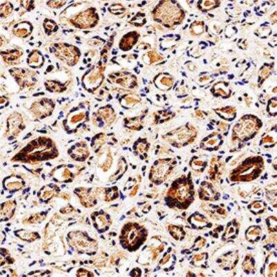 Immunohistochemistry-Paraffin: Endophilin B1/Bif-1 Antibody (30A882.1.1) - BSA Free [NBP2-24733]