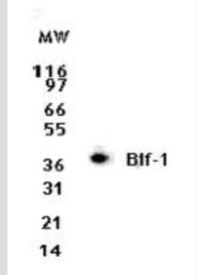 Western Blot: Endophilin B1/Bif-1 Antibody (30A882.1.1)BSA Free [NBP2-24733]