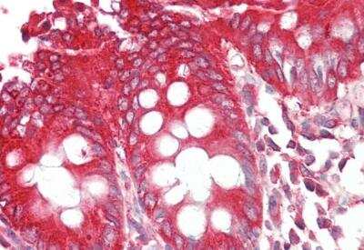 Immunohistochemistry-Paraffin: Endophilin B1/Bif-1 Antibody [NB100-820]