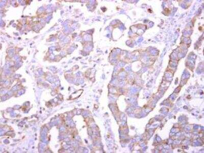 Immunohistochemistry-Paraffin: Endophilin B1/Bif-1 Antibody [NBP1-31130]