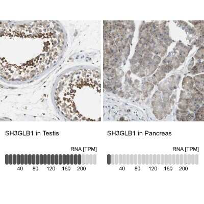 Immunohistochemistry-Paraffin: Endophilin B1/Bif-1 Antibody [NBP1-89972]