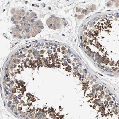 Immunohistochemistry-Paraffin: Endophilin B1/Bif-1 Antibody [NBP1-89973]