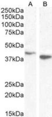 Western Blot: Endophilin B1/Bif-1 Antibody [NB100-820]