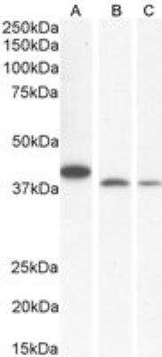 Western Blot: Endophilin B1/Bif-1 Antibody [NB100-820]