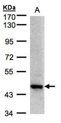 Western Blot: Endophilin B1/Bif-1 Antibody [NBP1-31130]