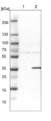 Western Blot: Endophilin B1/Bif-1 Antibody [NBP1-89973]