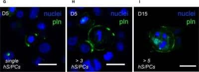 Immunocytochemistry/ Immunofluorescence: Endorepellin/Perlecan/Heparan Sulfate Proteoglycan Antibody (A76) - BSA Free [NBP1-05170]