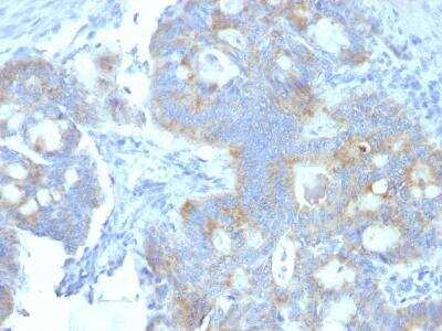 Immunohistochemistry-Paraffin: Endorepellin/Perlecan/Heparan Sulfate Proteoglycan Antibody (A7L6) - Azide and BSA Free [NBP2-47695]