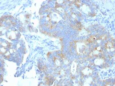 Immunohistochemistry-Paraffin: Endorepellin/Perlecan/Heparan Sulfate Proteoglycan Antibody (A7L6) - IHC-Prediluted [NBP2-48243]