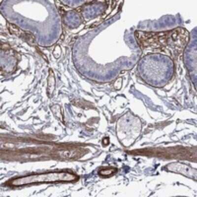 Immunohistochemistry-Paraffin: Endorepellin/Perlecan/Heparan Sulfate Proteoglycan Antibody [NBP3-17840]