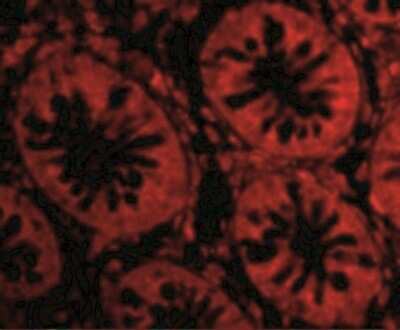 Immunohistochemistry: Endosialin/CD248/TEM1 Antibody - BSA Free [NBP1-77310]