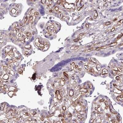 Immunohistochemistry-Paraffin: Endosialin/CD248/TEM1 Antibody [NBP2-14462]