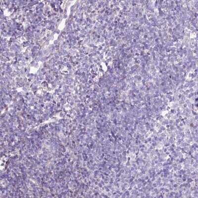 Immunohistochemistry-Paraffin: Endosialin/CD248/TEM1 Antibody [NBP2-14462]