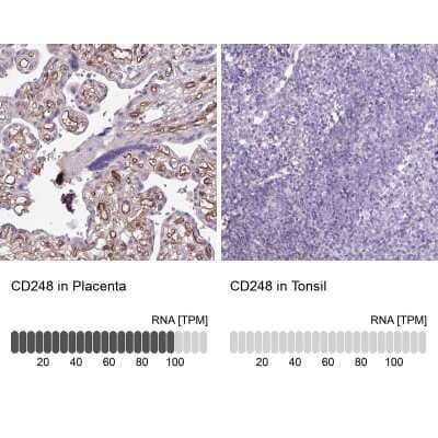 Immunohistochemistry-Paraffin: Endosialin/CD248/TEM1 Antibody [NBP2-14462]