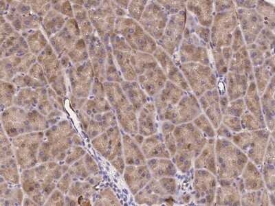 Immunohistochemistry-Paraffin: Endosialin/CD248/TEM1 Antibody [NBP2-99057]