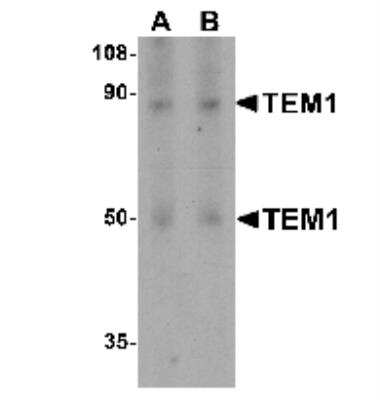 Western Blot: Endosialin/CD248/TEM1 AntibodyBSA Free [NBP1-77310]