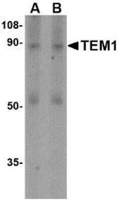Western Blot: Endosialin/CD248/TEM1 AntibodyBSA Free [NBP1-77311]