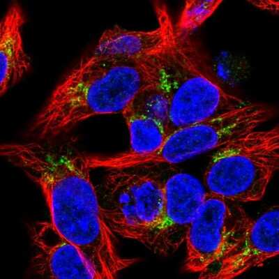 Immunocytochemistry/ Immunofluorescence: Endostatin Antibody [NBP2-55015]