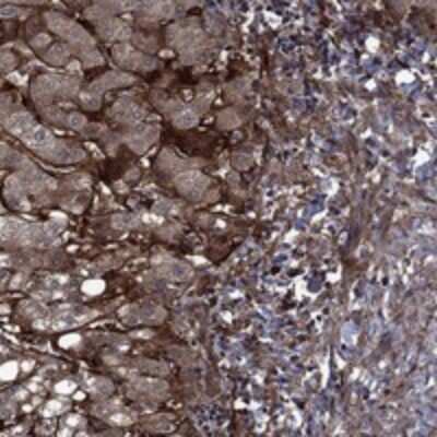 Immunohistochemistry-Paraffin: Endostatin Antibody [NBP3-17655]