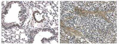 Immunohistochemistry-Paraffin: Endostatin Antibody (RM0060-3H11) - Azide and BSA Free [NBP2-12274]